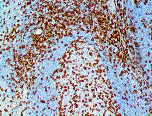 IHC of CD45 RO on an FFPE Tonsil Tissue